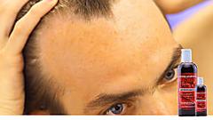 Get Bald or get Bold with Confidence Using 10 Days Hair Oil